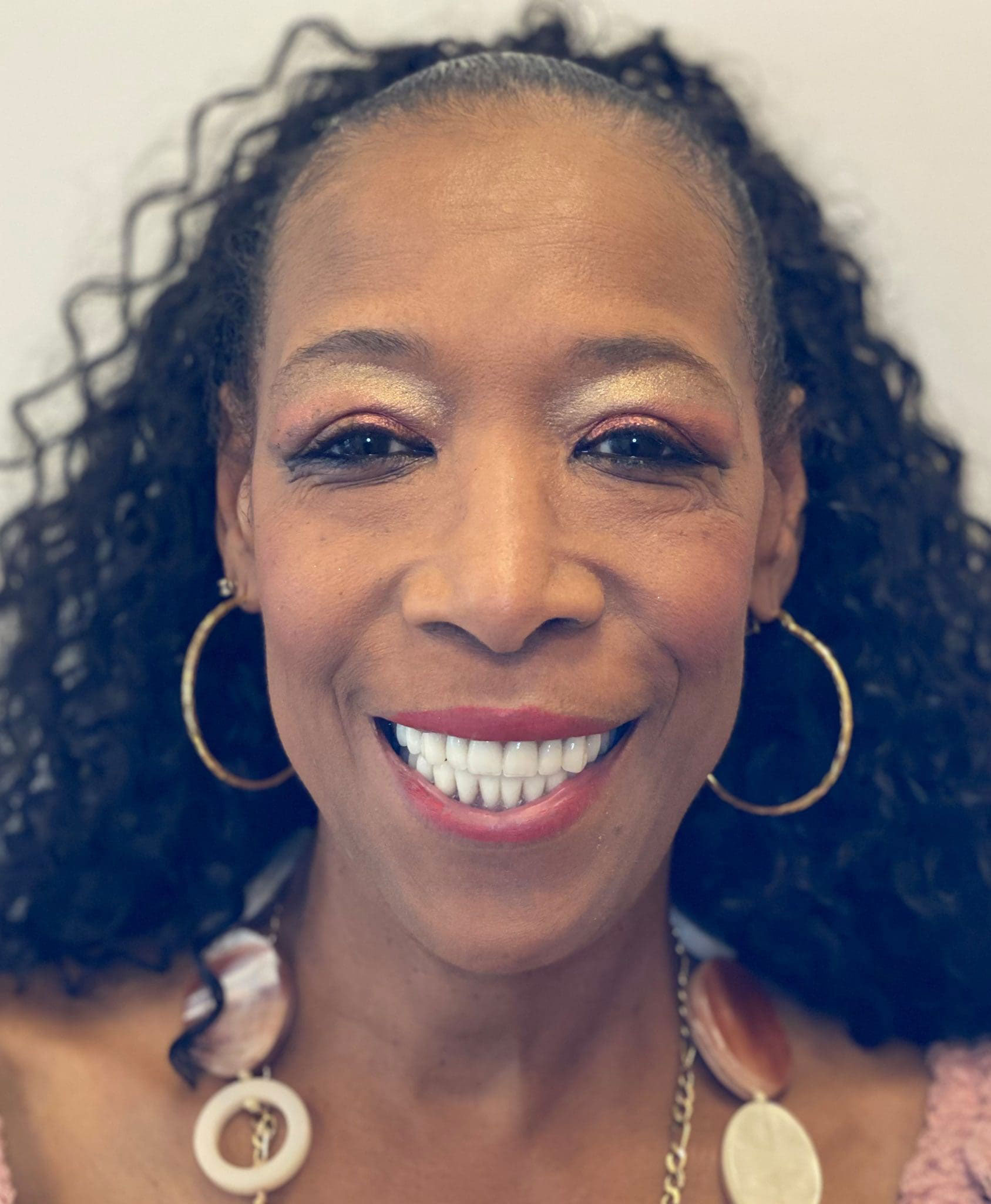 Dorothy smile with dentures